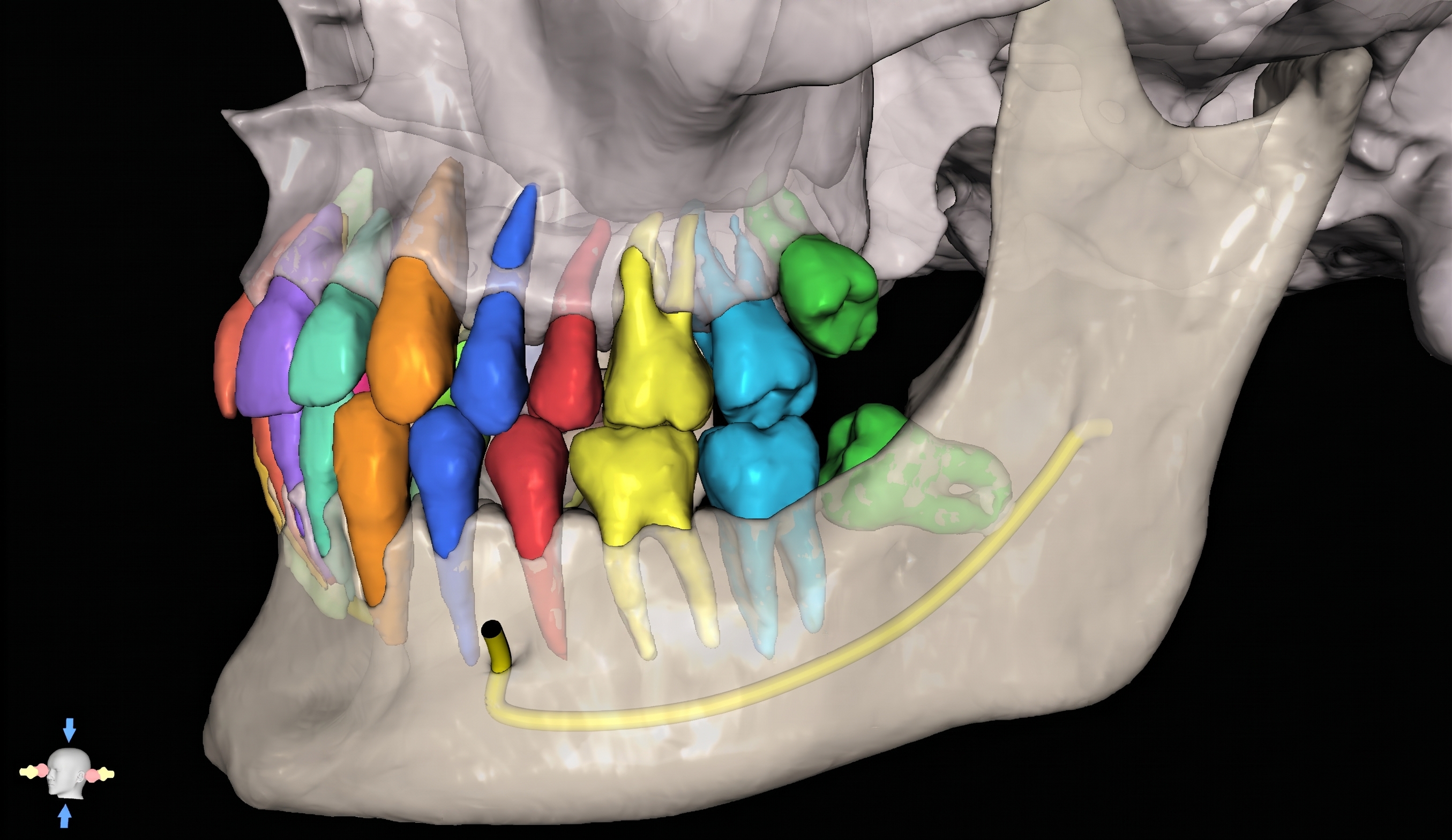 CBCT / DICOM